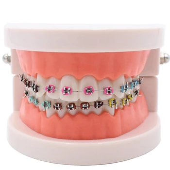 Dental Ortodôntica De Dentes Modelo Com Ortho Suporte De Metal Arco De Arame Buccals Tubo De Ligadura Empate Dentista Demonstração De Ensino Modelo